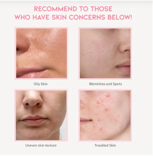 OOTD Clarifying Niacinamide Serum