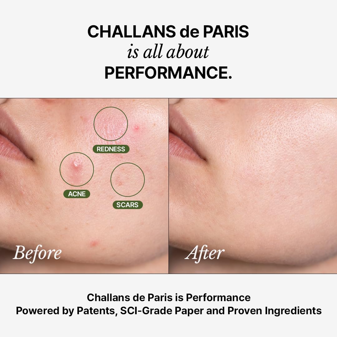 Challans de Paris Ampoule de Aurora