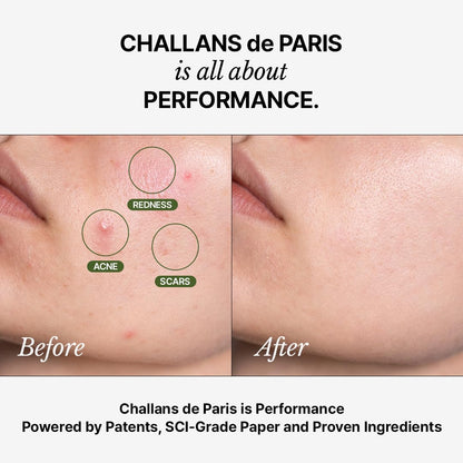 Challans de Paris Ampoule de Aurora